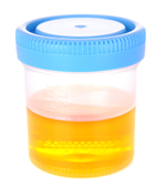 Urine tests for pets